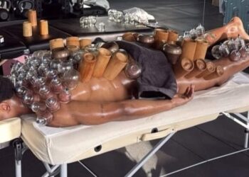 Openda le prova tutte: guardate a cosa si sottopone